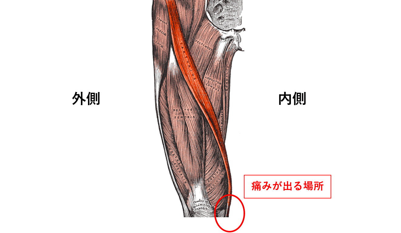 膝痛の原因箇所②：鵞足